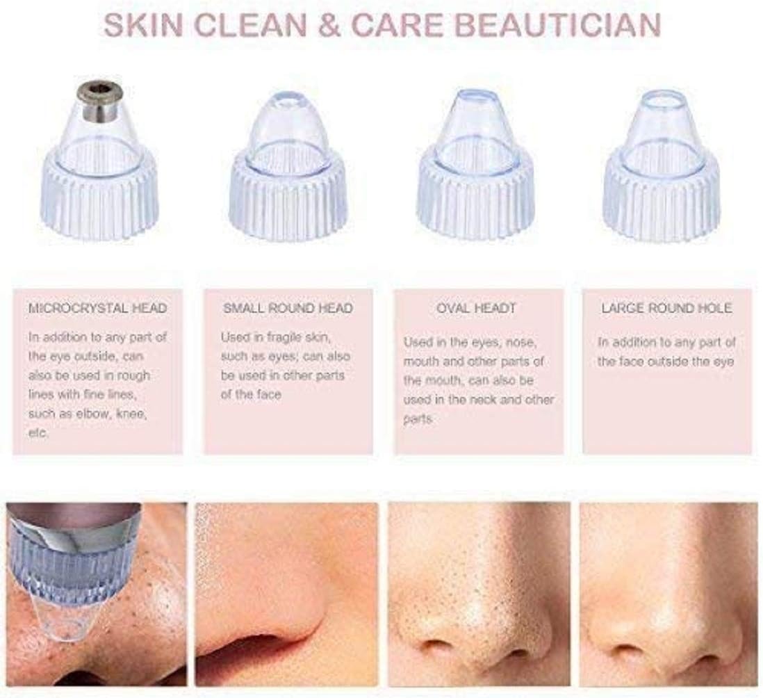 💆‍♀️ Pore Cleaning Device ✨ | Blackhead Remover Vacuum 🔋 USB Rechargeable 🌟